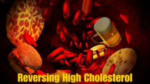 🥗 Can high cholesterol be reversed with diet?