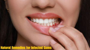 🪥”Holistic Healing for Gum Infections: Natural Remedies for a Healthier Smile”